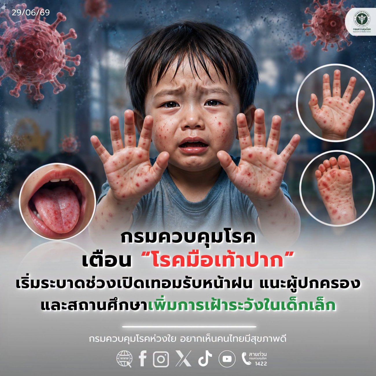 ข่าวประชาสัมพันธ์องค์การบริหารส่วนตำบลนาคำใหญ่  เรื่อง มือเท้าปาก